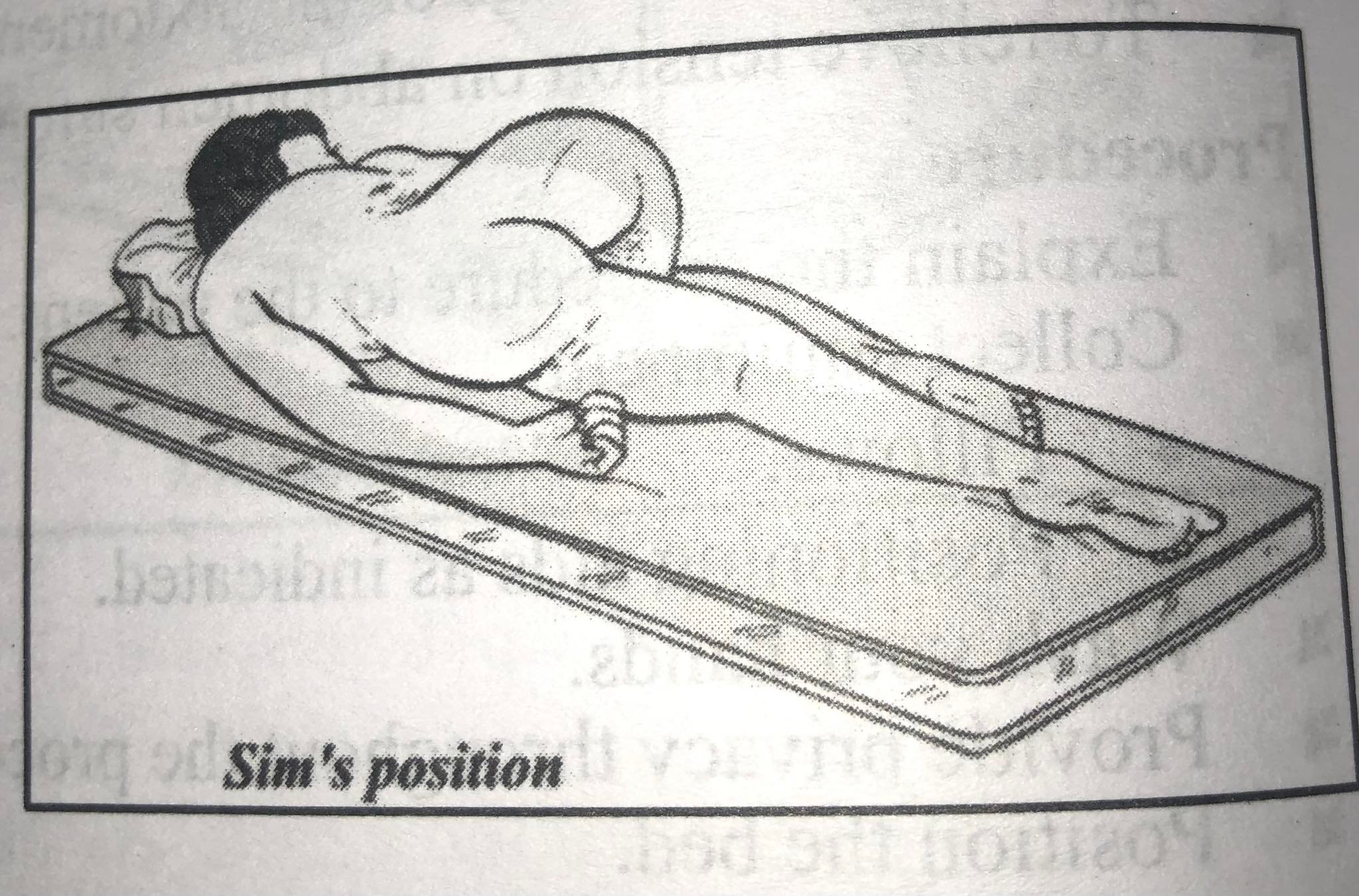 Supine position for casting